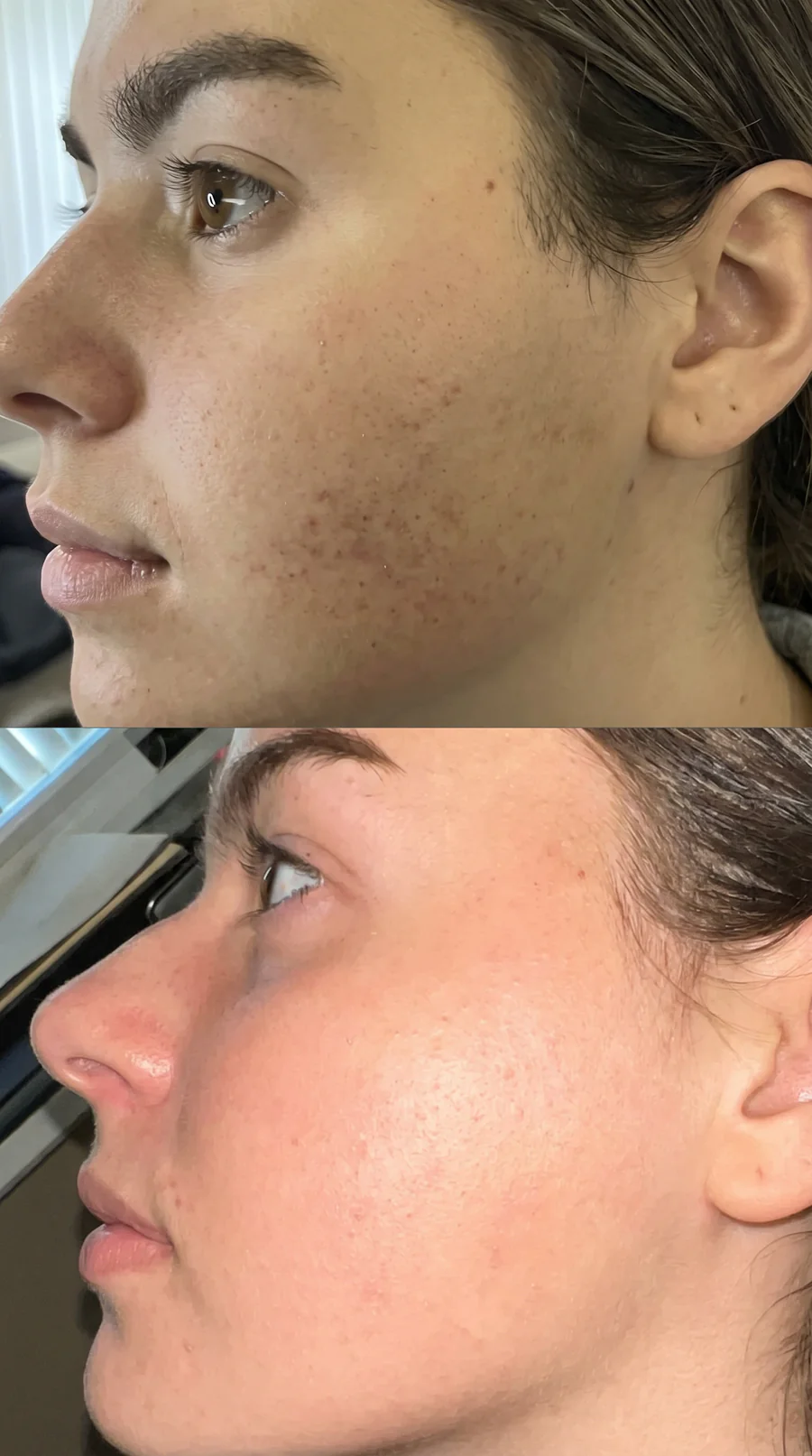 Rostro con piel más cuidada