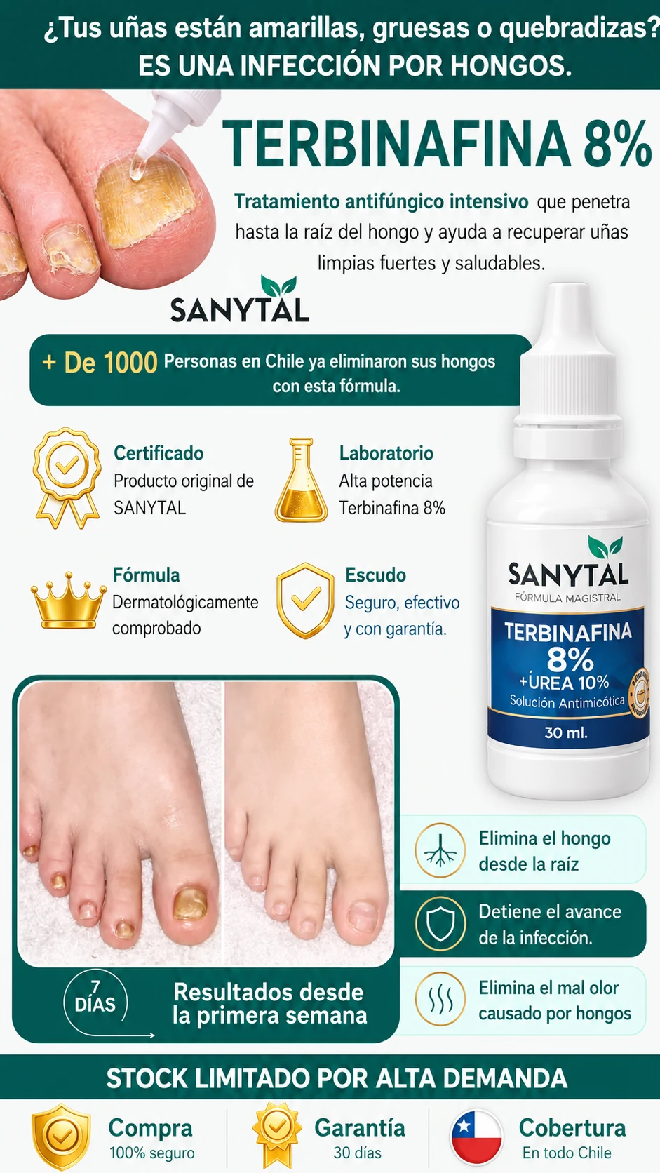 SANYTAL Terbinafina 8% + Úrea 10%